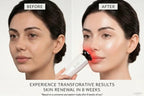 3-in-1 Red Light Facial Massager PRIME STORE Beauty Device PRIME STORE