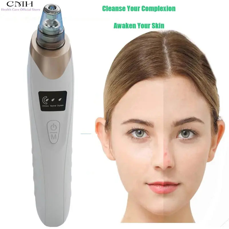 CMH Blackhead Remover Vacuum Pore Cleaner Multi Suction Heads Adjustable Suction USB Rechargeable Deep Cleansing Skin Tool Gifts PRIME STORE  PRIME STORE